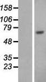 ALB / Serum Albumin Protein - Western validation with an anti-DDK antibody * L: Control HEK293 lysate R: Over-expression lysate