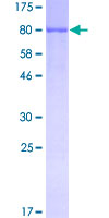 ALB / Serum Albumin Protein - 12.5% SDS-PAGE of human ALB stained with Coomassie Blue