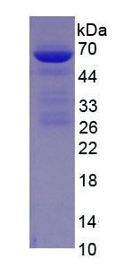 ALB / Serum Albumin Protein - Eukaryotic Albumin (ALB) by SDS-PAGE