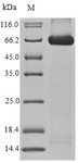 ALCAM / CD166 Protein - (Tris-Glycine gel) Discontinuous SDS-PAGE (reduced) with 5% enrichment gel and 15% separation gel.