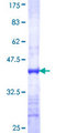 ALCAM / CD166 Protein - 12.5% SDS-PAGE Stained with Coomassie Blue.