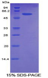 ALCAM / CD166 Protein - Recombinant Activated Leukocyte Cell Adhesion Molecule By SDS-PAGE
