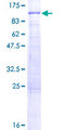 ALDH16A1 Protein - 12.5% SDS-PAGE of human ALDH16A1 stained with Coomassie Blue