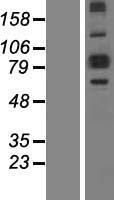 ALDH18A1 Protein - Western validation with an anti-DDK antibody * L: Control HEK293 lysate R: Over-expression lysate