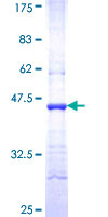 ALDH18A1 Protein - 12.5% SDS-PAGE Stained with Coomassie Blue