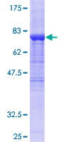 ALDH1A1 / ALDH1 Protein - 12.5% SDS-PAGE of human ALDH1A1 stained with Coomassie Blue