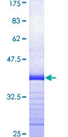 ALDH1A1 / ALDH1 Protein - 12.5% SDS-PAGE Stained with Coomassie Blue.
