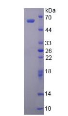 ALDH1A1 / ALDH1 Protein - Active Aldehyde Dehydrogenase 1 Family, Member A1 (ALDH1A1) by SDS-PAGE