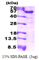 ALDH1A1 / ALDH1 Protein