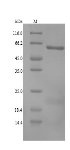 ALDH1A3 Protein - (Tris-Glycine gel) Discontinuous SDS-PAGE (reduced) with 5% enrichment gel and 15% separation gel.