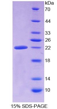 ALDH1A3 Protein - Recombinant Aldehyde Dehydrogenase 1 Family, Member A3 By SDS-PAGE