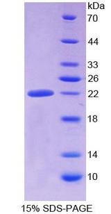 ALDH1A3 Protein - Recombinant Aldehyde Dehydrogenase 1 Family, Member A3 By SDS-PAGE