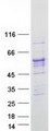 ALDH1B1 Protein - Purified recombinant protein ALDH1B1 was analyzed by SDS-PAGE gel and Coomassie Blue Staining