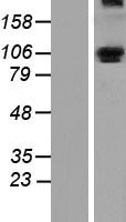 ALDH1L1 Protein - Western validation with an anti-DDK antibody * L: Control HEK293 lysate R: Over-expression lysate