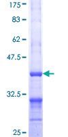 ALDH1L1 Protein - 12.5% SDS-PAGE Stained with Coomassie Blue.