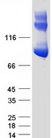 ALDH1L1 Protein - Purified recombinant protein ALDH1L1 was analyzed by SDS-PAGE gel and Coomassie Blue Staining