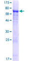 ALDH1L2 Protein - 12.5% SDS-PAGE of human ALDH1L2 stained with Coomassie Blue