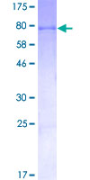 ALDH2 Protein - 12.5% SDS-PAGE of human ALDH2 stained with Coomassie Blue