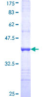 ALDH2 Protein - 12.5% SDS-PAGE Stained with Coomassie Blue.