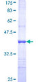 ALDH2 Protein - 12.5% SDS-PAGE Stained with Coomassie Blue.