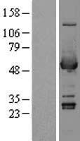 ALDH3A1 Protein - Western validation with an anti-DDK antibody * L: Control HEK293 lysate R: Over-expression lysate