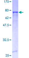 ALDH3A1 Protein - 12.5% SDS-PAGE of human ALDH3A1 stained with Coomassie Blue
