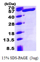 ALDH3A1 Protein