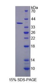 ALDH3A1 Protein - Recombinant Aldehyde Dehydrogenase 3 Family, Member A1 By SDS-PAGE