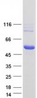 ALDH3A2 Protein - Purified recombinant protein ALDH3A2 was analyzed by SDS-PAGE gel and Coomassie Blue Staining