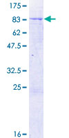 ALDH5A1 Protein - 12.5% SDS-PAGE of human ALDH5A1 stained with Coomassie Blue