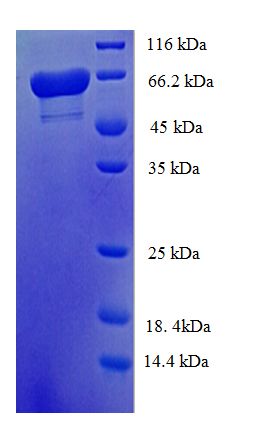 ALDH5A1 Protein