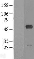ALDH6A1 Protein - Western validation with an anti-DDK antibody * L: Control HEK293 lysate R: Over-expression lysate