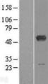 ALDH6A1 Protein - Western validation with an anti-DDK antibody * L: Control HEK293 lysate R: Over-expression lysate