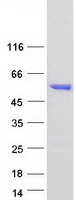 ALDH6A1 Protein - Purified recombinant protein ALDH6A1 was analyzed by SDS-PAGE gel and Coomassie Blue Staining