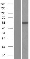 ALDH7A1 Protein - Western validation with an anti-DDK antibody * L: Control HEK293 lysate R: Over-expression lysate