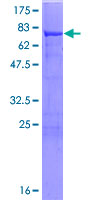 ALDH7A1 Protein - 12.5% SDS-PAGE of human ALDH7A1 stained with Coomassie Blue