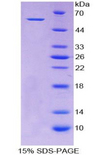 ALDH7A1 Protein - Recombinant Aldehyde Dehydrogenase 7 Family, Member A1 By SDS-PAGE