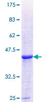 ALDH8A1 Protein - 12.5% SDS-PAGE Stained with Coomassie Blue.