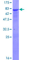 ALDH9A1 Protein - 12.5% SDS-PAGE of human ALDH9A1 stained with Coomassie Blue