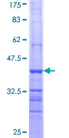 ALDH9A1 Protein - 12.5% SDS-PAGE Stained with Coomassie Blue.