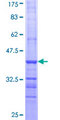 ALDH9A1 Protein - 12.5% SDS-PAGE Stained with Coomassie Blue.