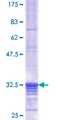 ALDOA / Aldolase A Protein - 12.5% SDS-PAGE Stained with Coomassie Blue.