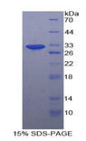 ALDOA / Aldolase A Protein - Recombinant Aldolase A, Fructose Bisphosphate By SDS-PAGE