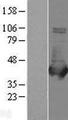 ALDOB Protein - Western validation with an anti-DDK antibody * L: Control HEK293 lysate R: Over-expression lysate