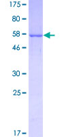 ALDOB Protein - 12.5% SDS-PAGE of human ALDOB stained with Coomassie Blue