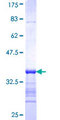 ALDOB Protein - 12.5% SDS-PAGE Stained with Coomassie Blue.