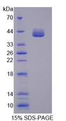 ALDOB Protein - Recombinant Aldolase B, Fructose Bisphosphate By SDS-PAGE