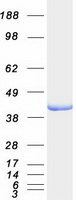 ALDOB Protein - Purified recombinant protein ALDOB was analyzed by SDS-PAGE gel and Coomassie Blue Staining