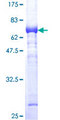 ALDOC / Aldolase C Protein - 12.5% SDS-PAGE of human ALDOC stained with Coomassie Blue