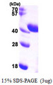 ALDOC / Aldolase C Protein